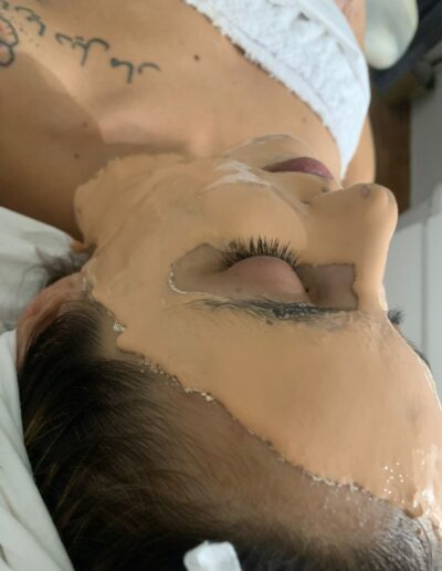 tratamientofacial2